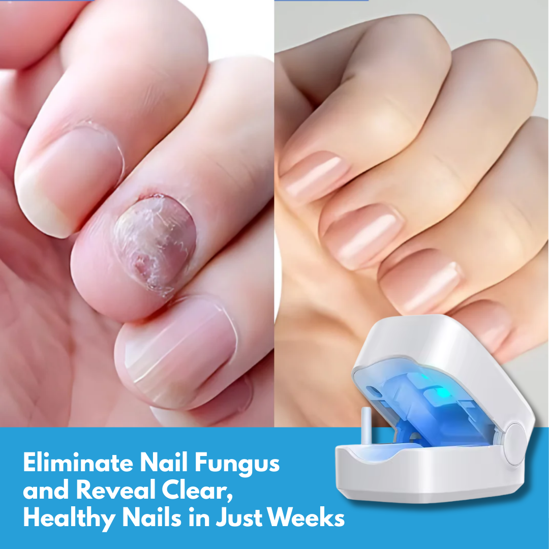 FungaLite Restore™