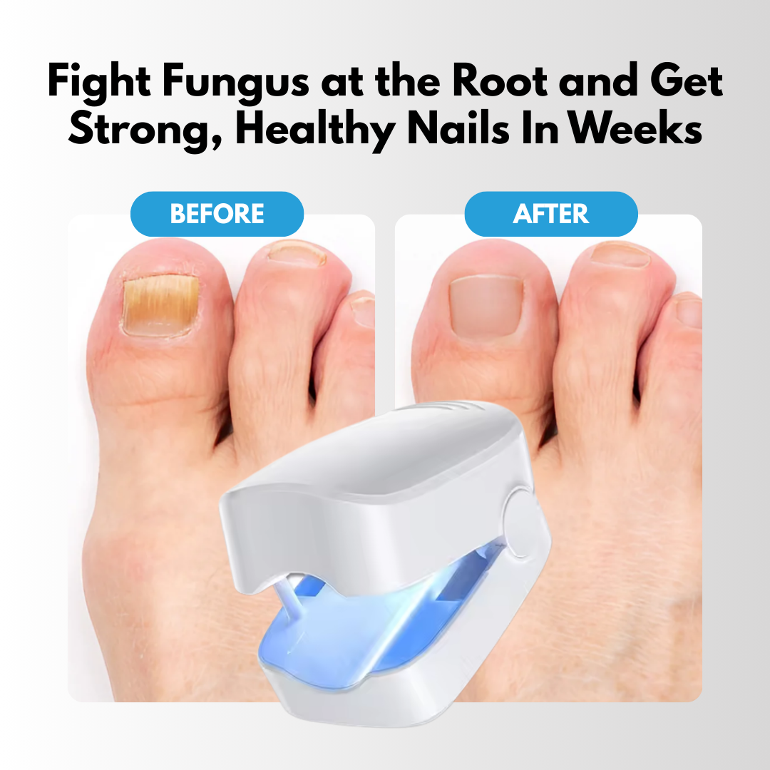 FungaLite Restore™